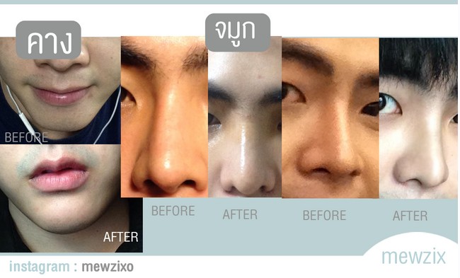 ศัลยกรรม